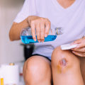 What Does an Infected Cut Look Like? When to Seek Medical Attention