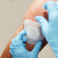 Iodoform Packing Uses That Doctors Trust for Deep Wound Care