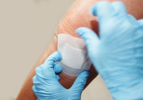 Iodoform Packing Uses That Doctors Trust for Deep Wound Care